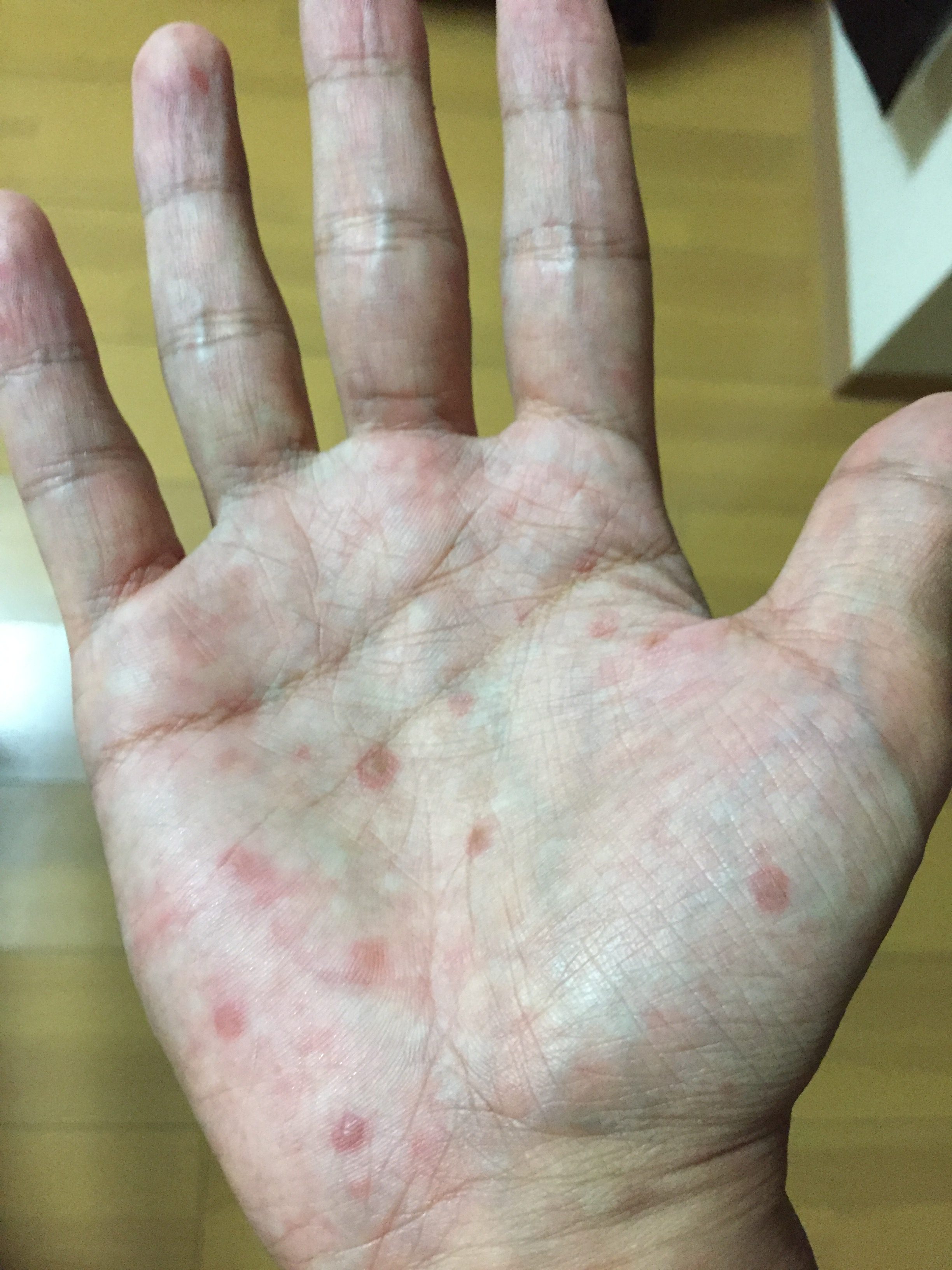 実際の症例１